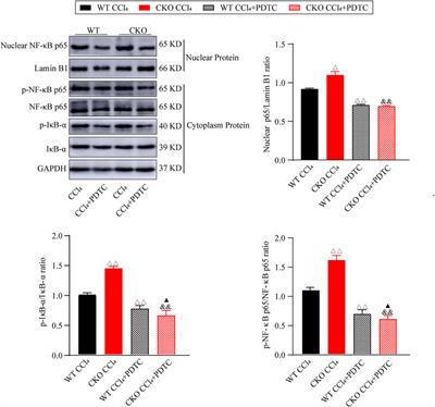 Phosphatidylethanolamine-binding protein 4 deficiency exacerbates carbon tetrachloride-induced liver fibrosis by regulating the NF-κB signaling pathway